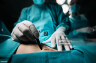 Close up of a certified plastic surgeon with gloved hands marking the human skin for surgery.